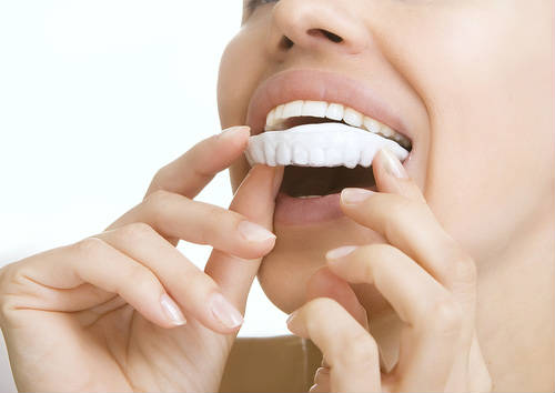 Teeth Whitening in Oakley, CA